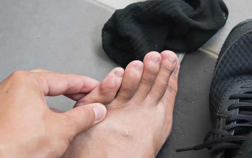 Бегун's Feet: The 5 Most Common Injuries, and Foot Care For Runners 1